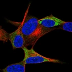 Immunofluorescent staining of human cell line SH-SY5Y shows localization to cytosol.