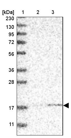 Anti-MRPS24 Antibody