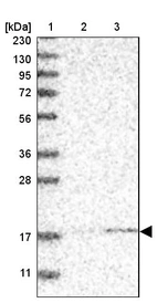 Anti-MRPS24 Antibody
