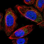 Immunofluorescent staining of human cell line PC-3 shows localization to vesicles.
