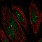 Immunofluorescent staining of human cell line SiHa shows localization to nucleoplasm & nuclear bodies.