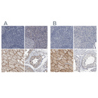 Immunohistochemical staining of human lymphoid tissues, pancreas, skeletal muscle and testis using Anti-MURC antibody HPA020987 (A) shows similar protein distribution across tissues to independent antibody HPA020973 (B).