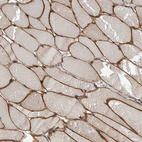 Immunohistochemical staining of human skeletal muscle shows strong membranous positivity in myocytes.