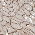 Immunohistochemical staining of human skeletal muscle shows strong membranous positivity in myocytes.