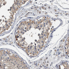 Immunohistochemical staining of human testis shows moderate cytoplasmic positivity in cells in seminiferous ducts.