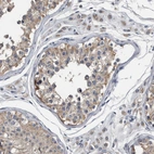 Immunohistochemical staining of human testis shows moderate cytoplasmic positivity in cells in seminiferous ducts.