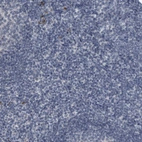 Immunohistochemical staining of human tonsil shows no positivity in non-germinal center cells as expected.