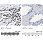 Anti-ZFAT Antibody