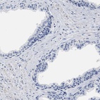 Anti-ZFAT Antibody