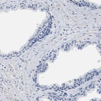 Immunohistochemical staining of human prostate shows low expression as expected.