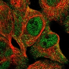 Immunofluorescent staining of human cell line A-431 shows localization to nucleoplasm & cytosol.