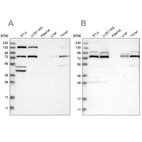 Western blot analysis using Anti-PLAA antibody HPA020994 (A) shows similar pattern to independent antibody HPA020996 (B).