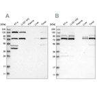 Western blot analysis using Anti-PLAA antibody HPA020994 (A) shows similar pattern to independent antibody HPA020996 (B).