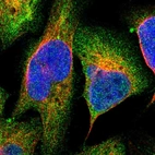 Immunofluorescent staining of human cell line U-2 OS shows localization to cytosol.