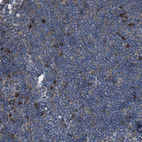 Immunohistochemical staining of human Lymph node shows moderate cytoplasmic positivity in non-germinal center cells.