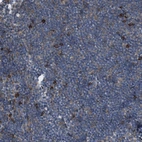 Immunohistochemical staining of human Lymph node shows moderate cytoplasmic positivity in non-germinal center cells.