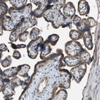 Immunohistochemical staining of human Placenta shows moderate cytoplasmic positivity in trophoblastic cells.