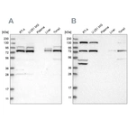 Western blot analysis using Anti-PLAA antibody HPA020996 (A) shows similar pattern to independent antibody HPA020994 (B).