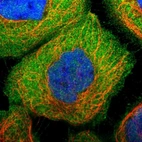 Immunofluorescent staining of human cell line A-431 shows localization to nucleoplasm, plasma membrane & cytosol.