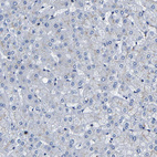 Immunohistochemical staining of human liver shows no positivity in hepatocytes as expected.