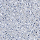 Immunohistochemical staining of human liver shows no positivity in hepatocytes as expected.