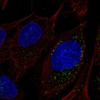 Immunofluorescent staining of human cell line U-2 OS shows localization to vesicles.