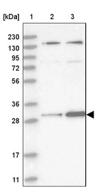 Lane 1: Marker [kDa] 230, 130, 95, 72, 56, 36, 28, 17, 11_br/_Lane 2: Human cell line RT-4_br/_Lane 3: Human cell line U-251MG sp