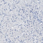 Immunohistochemical staining of human liver shows low expression as expected.