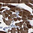 Immunohistochemical staining of human skeletal muscle shows high expression.