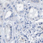 Immunohistochemical staining of human kidney using Anti-MYBPC1 antibody HPA021004.