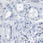 Immunohistochemical staining of human kidney using Anti-MYBPC1 antibody HPA021004.