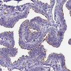 Immunohistochemical staining of human Fallopian tube shows strong positivity in cilia in glandular cells.