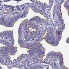 Immunohistochemical staining of human Fallopian tube shows strong positivity in cilia in glandular cells.