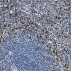 Immunohistochemical staining of human spleen shows strong cytoplasmic positivity in cells in red pulp.