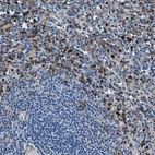 Immunohistochemical staining of human spleen shows strong cytoplasmic positivity in cells in red pulp.