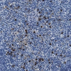 Immunohistochemical staining of human lymph node shows strong cytoplasmic positivity in non-germinal center cells.