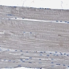 Immunohistochemical staining of human skeletal muscle shows no positivity in myocytes as expected.