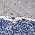Immunohistochemical staining of human cerebellum shows moderate cytoplasmic positivity in Purkinje cells.
