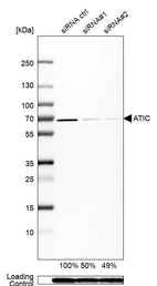 Western blot analysis in Caco-2 cells transfected with control siRNA, target specific siRNA probe #1 and #2, using Anti-ATIC antibody. Remaining relative intensity is presented. Loading control: Anti-GAPDH.