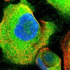 Immunofluorescent staining of human cell line A-431 shows positivity in plasma membrane & cytoplasm.
