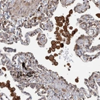 Immunohistochemical staining of human lung shows strong membranous and cytoplasmic positivity in macrophages.