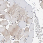 Immunohistochemical staining of human skeletal muscle shows no memranous and cytoplasmic positivity in myocytes as expected.