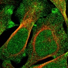 Immunofluorescent staining of human cell line U-2 OS shows localization to nucleus & cytosol.