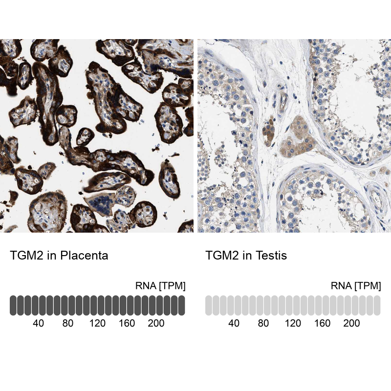 Anti-TGM2 Antibody