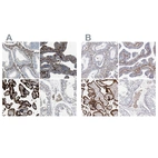 Immunohistochemical staining of human endometrium, fallopian tube, placenta and testis using Anti-TGM2 antibody HPA021019 (A) shows similar protein distribution across tissues to independent antibody HPA029518 (B).