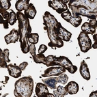 Immunohistochemical staining of human placenta shows very strong cytoplasmic positivity in trophoblastic cells.