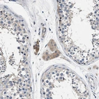 Immunohistochemical staining of human testis shows weak cytoplasmic positivity in Leydig cells.