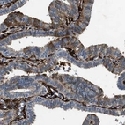 Immunohistochemical staining of human Fallopian tube shows strong cytoplasmic positivity in stromal cells.