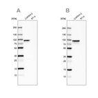 Western blot analysis using Anti-TGM2 antibody HPA021019 (A) shows similar pattern to independent antibody HPA029518 (B).