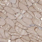 Immunohistochemical staining of human skeletal muscle shows strong membranous positivity in myocytes.